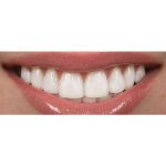 چطور دندان های سفید داشته باشیم