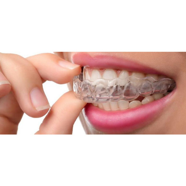 نایت گارد دندان